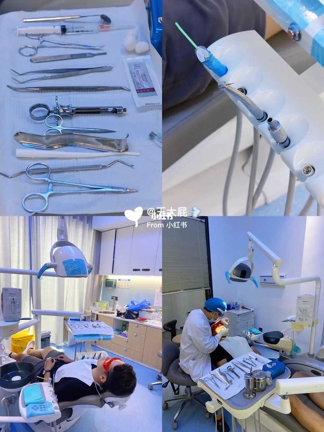 牙医拔牙需要很大力气吗_牙医不建议我拔牙_牙医建议拔牙可信吗