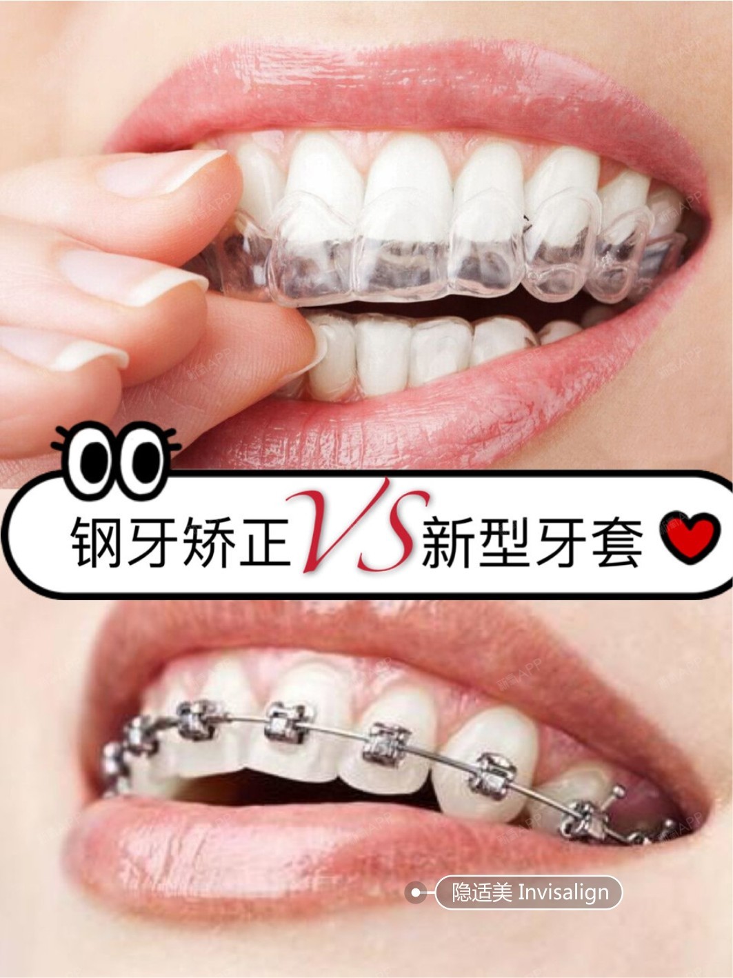 震撼金属世界：我与大钢牙的亲密邂逅